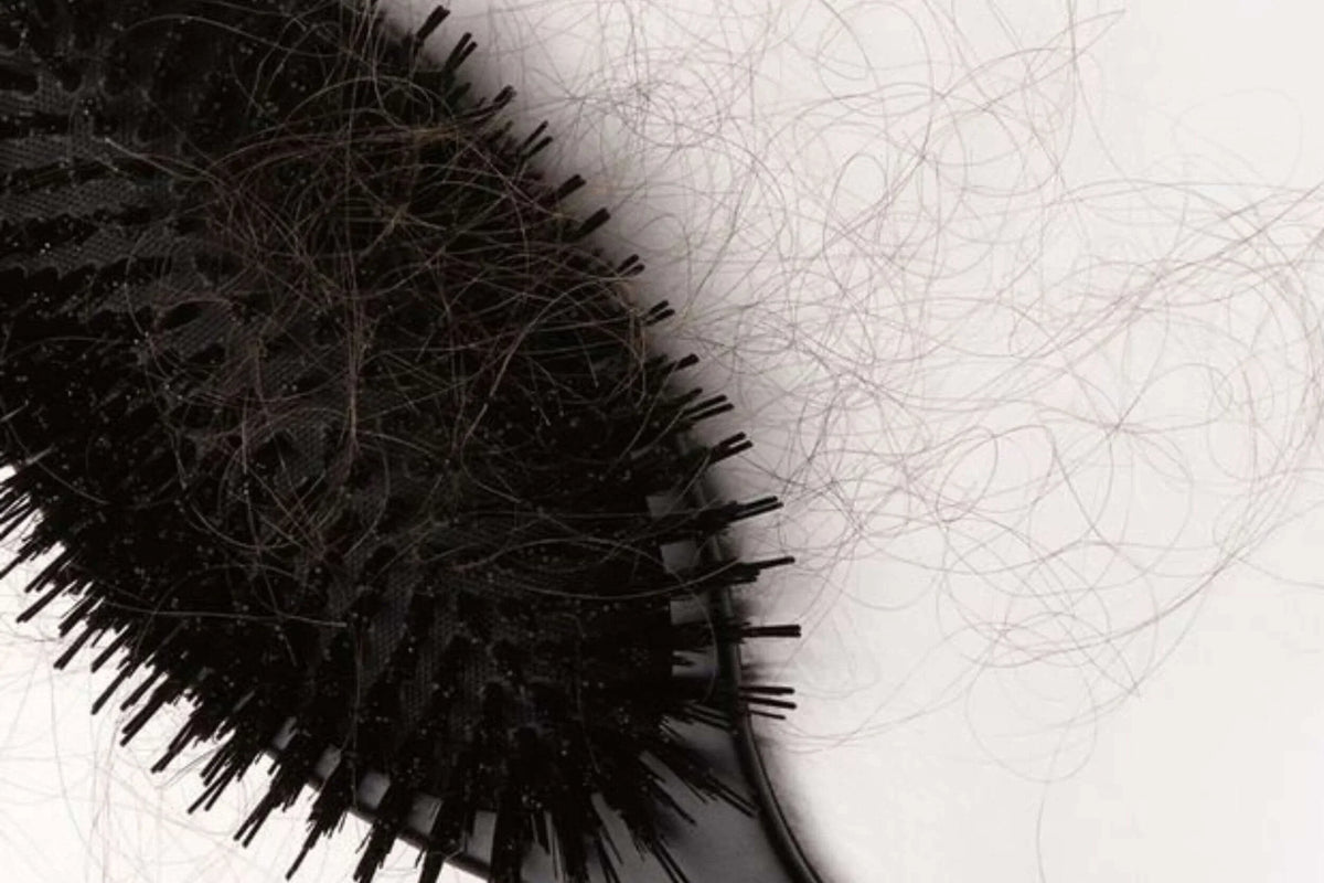 Tout savoir sur la perte de cheveux saisonnière